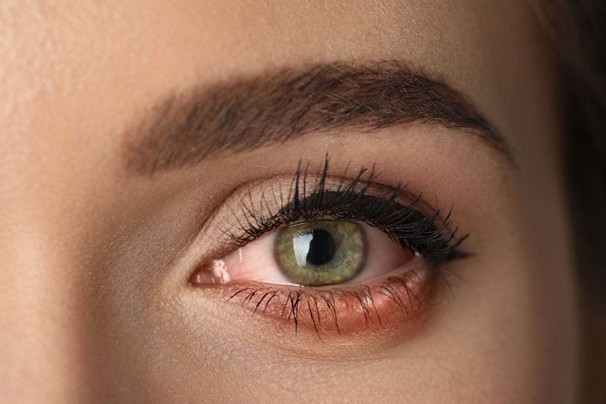 10 Signs of Dry Eyes and the Best Treatments